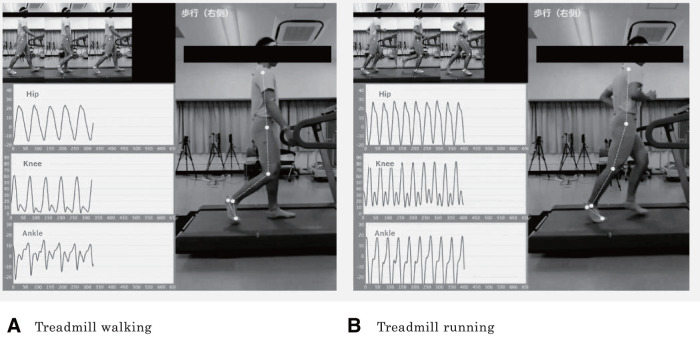 Markerless Motion Analysis Using New Digital Technology.