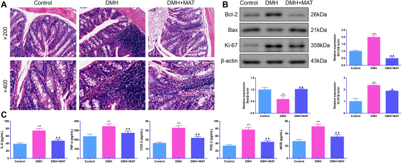 Matrine Alleviates Oxidative Stress and Inflammation in Colon Cancer by Activating the Nrf2 Pathway.