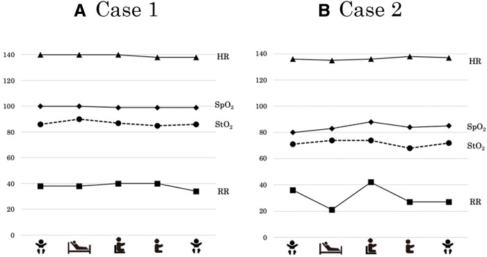 Skeletal Muscle Oxygen Dynamics during Rehabilitation of Children with Congenital Heart Disease: A Comparative Study of Two Cases.