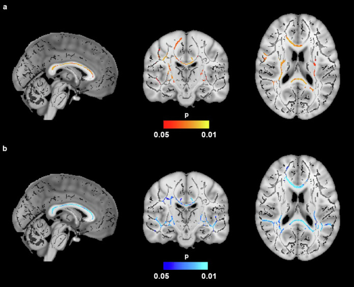 Identifying obesity and dementia risk: body adiposity and neural connectivity in cognitively normal, mid-life adults.
