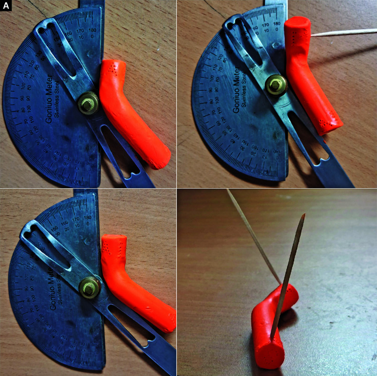 What is the Geometric Rule that Guides Accurate Vertical Orientation of the Single-cut Inclined Osteotomy in a Combined Angulation-rotation Deformity of Long Bone?