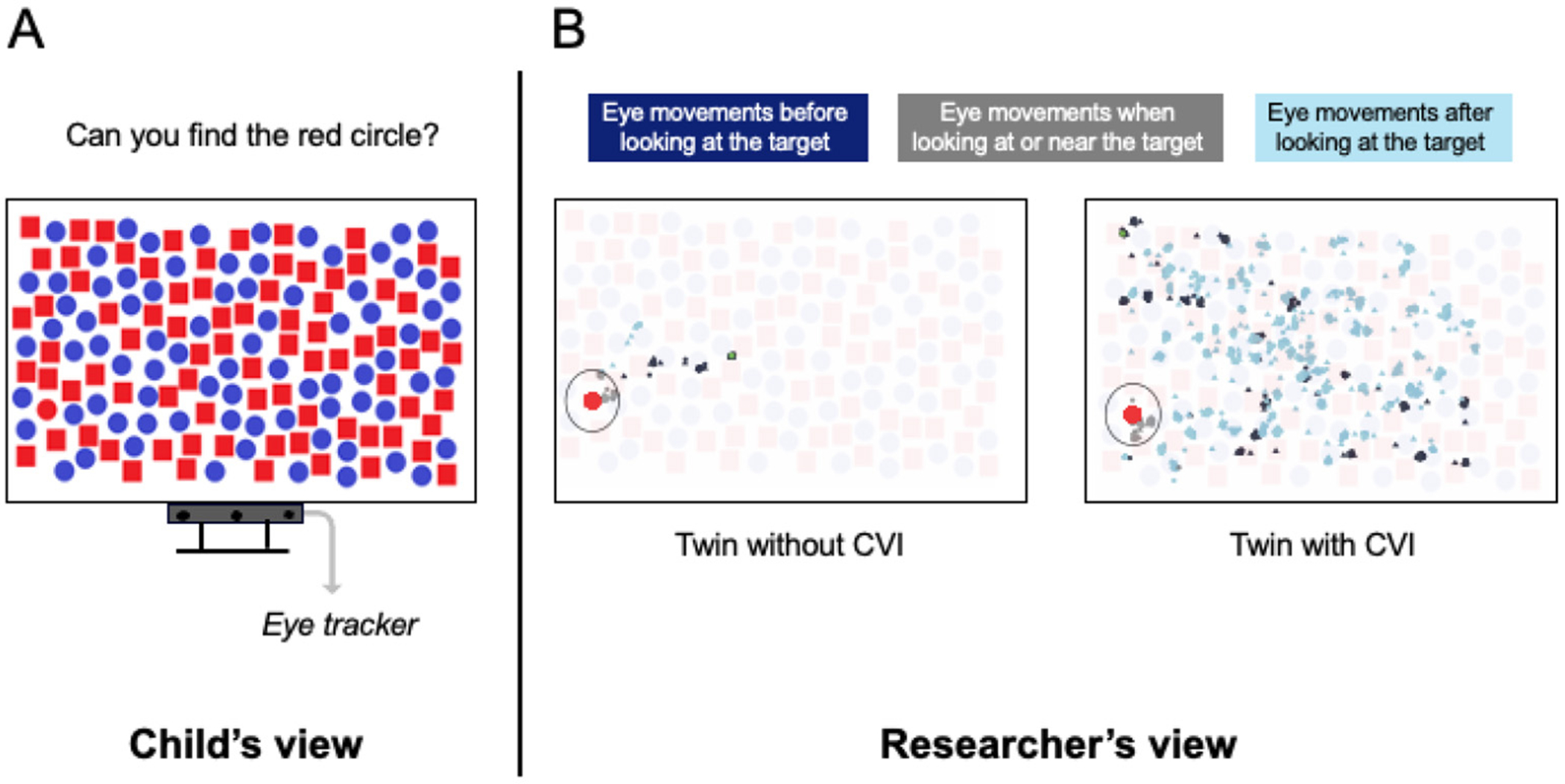 CEREBRAL VISUAL IMPAIRMENT: WHEN THE EYES CAN SEE BUT THE BRAIN DOES NOT FIND.