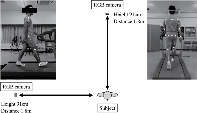 Markerless Motion Analysis Using New Digital Technology.
