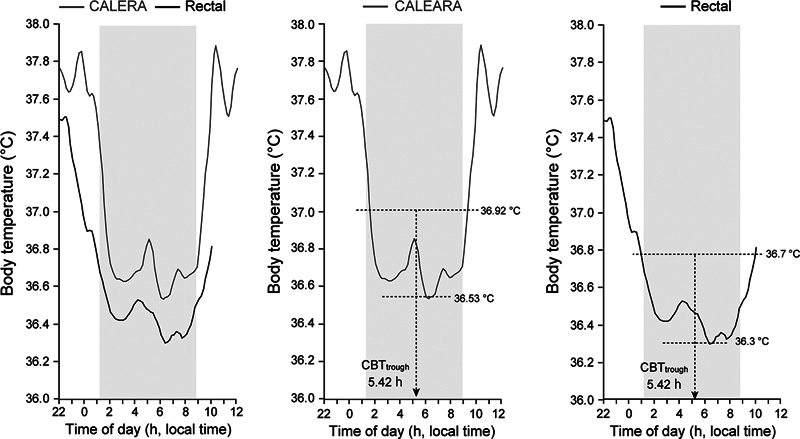 Circadian Phase Assessment of Core Body Temperature Using a Wearable Temperature Sensor Under the Real World.