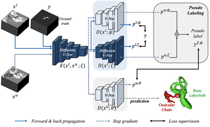 Artificial intelligence model for automatic 3-dimensional reconstruction of ossicular chain and bony labyrinth from high-resolution CT.