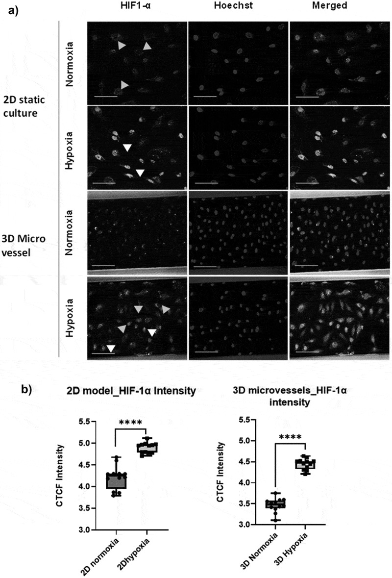 Metabolic alterations of endothelial cells under transient and persistent hypoxia: study using a 3D microvessels-on-chip model.