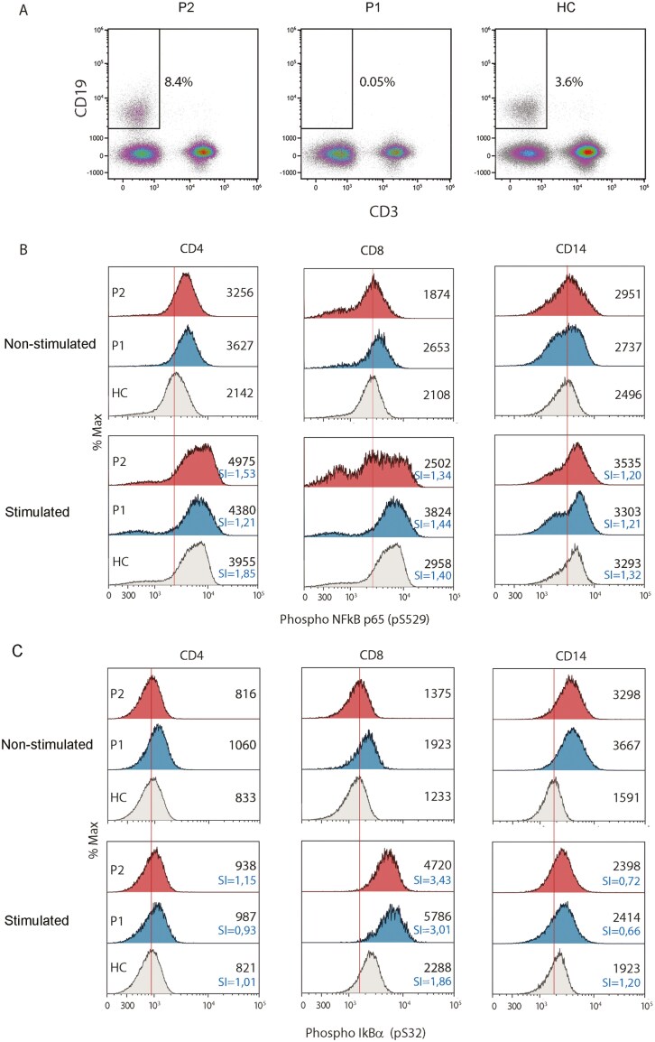 A novel missense variant in TNFAIP3 associated with autoimmunity reveals the contribution of STAT1/mTOR pathways.