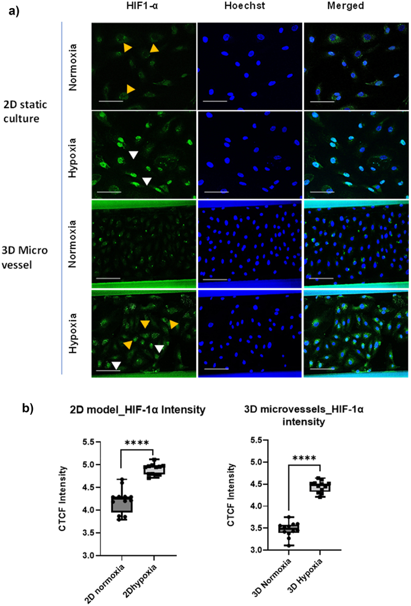 Metabolic alterations of endothelial cells under transient and persistent hypoxia: study using a 3D microvessels-on-chip model.