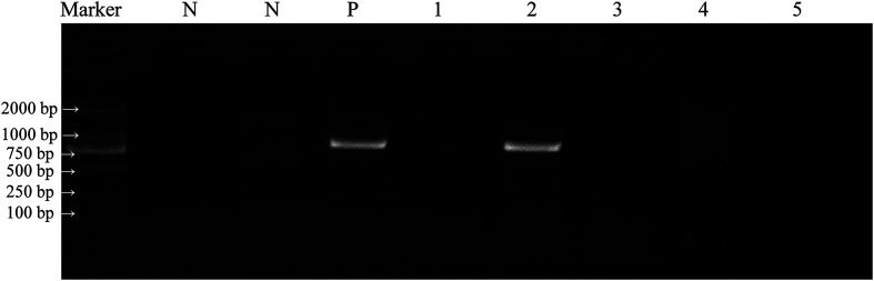 Cryptosporidium spp. in wild rodents in the Poyang Lake region, China.
