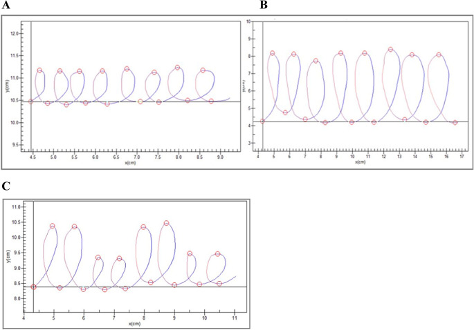 Anhedonia Relates to Increased Psychomotor Retardation Using an Instrumental Handwriting-Based Measure.