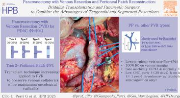 Pancreatectomy with venous resection and peritoneal patch reconstruction: bridging transplantation and pancreatic surgery to combine the advantages of tangential and segmental resections
