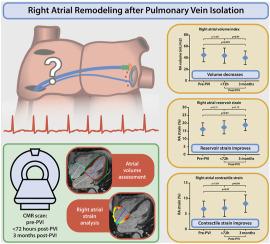 Right atrial reverse remodeling after pulmonary vein isolation: Analyzing changes in volume and function using cardiac magnetic resonance imaging