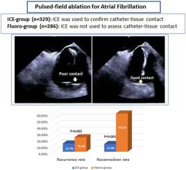 Ensuring catheter-tissue contact with intracardiac echocardiography during pulsed-field ablation improves procedure outcome in patients with atrial fibrillation