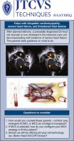Neonatal paracorporeal ventricular assist device as bridge to neonatal heart transplant: Case report