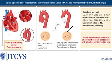 Valve-sparing aortic root replacement in bicuspid aortic valves—the reimplantation technique: A multicenter study