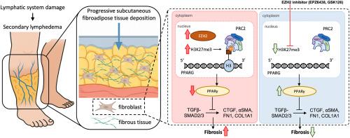 Epigenetic reprogramming via EZH2 inhibition rescues fibroadipose pathogenesis in secondary lymphedema through activating PPARγ signaling