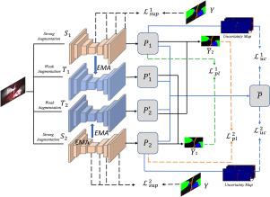 UTMT: Semi-supervised segmentation of surgical endoscopic images based on Uncertainty guided Twin Mean Teacher