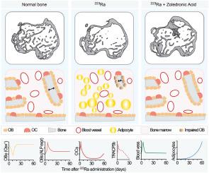 Dissecting the effects of 223Radium on the bone microenvironment