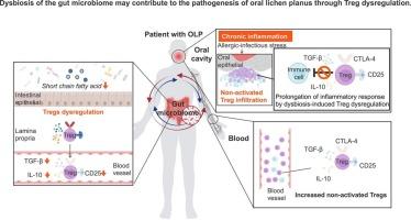 Dysbiosis of the gut microbiome may contribute to the pathogenesis of oral lichen planus through Treg dysregulation