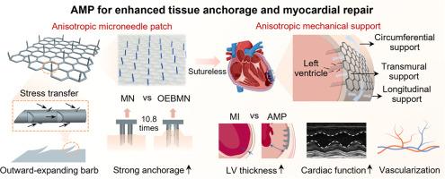 An anisotropic cardiac patch with barbed microneedles for enhanced tissue anchorage and myocardial repair