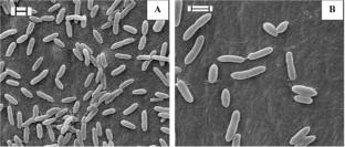 Citrobacter freundii induced pathogenicity towards fish: an insight investigation through serum biochemistry and gene expression analysis in Labeo rohita