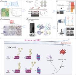 SPINT2 inhibits NEDD4L-mediated ACSL4 ubiquitination to promote ferroptosis and suppress gallbladder cancer progression