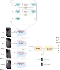 A new time-decay radiomics integrated network (TRINet) for breast cancer risk prediction