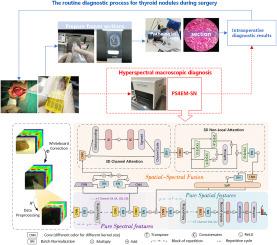 Fusion and pure feature extraction framework for intraoperative hyperspectral of thyroid lesion
