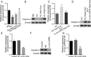Exosomes from hypoxic pre-treated BMSCs protect against lipopolysaccharide-induced acute lung injury via delivery of circ-LRP6