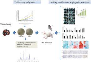 Optimization of the formulation of Tubiechong gel plaster and its effect on fracture healing by promoting angiogenesis in a rat model