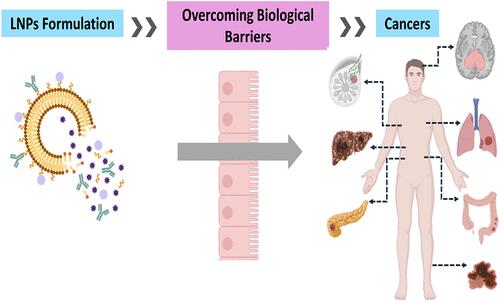 Theranostic Applications of Tailored Lipid-based Nanoparticles as Drug Delivery Systems for Cancer Treatment