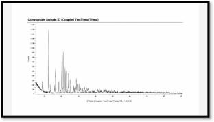 Design and Development of a pH-Responsive In-situ Gel of Brinzolamide for Ocular Delivery Using Quality by Design (QbD): Formulation Optimization, Characterization, and In-vivo Evaluation for Sustained Glaucoma Management
