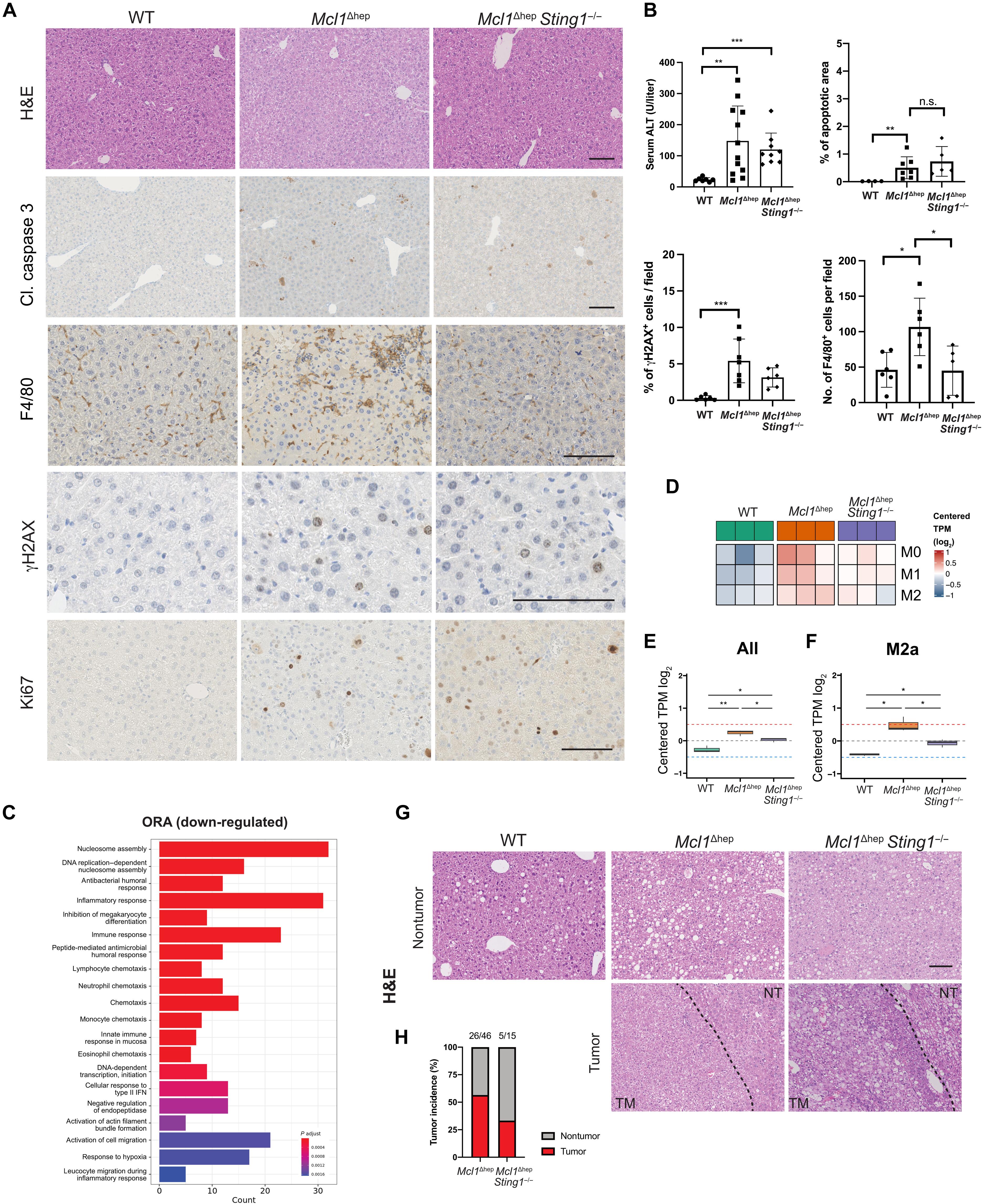 Extrachromosomal circular DNA promotes inflammation and hepatocellular carcinoma development