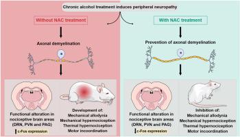 N-acetylcysteine prevents ethanol-induced neuropathic pain by downregulating nociceptive activation of supraspinal brain areas