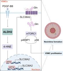ALDH2 deficiency aggravates vascular injury-induced restenosis by enhancing vascular smooth muscle cell proliferation through SLC38A2-mediated upregulation of glutamine uptake