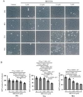 TGF-β signaling regulates gene expression, phagocytosis, and cell proliferation and supports glial cell survival in primary rat mixed glial cell cultures