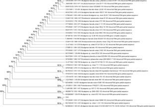 Effect of urea concentration on the combined pollution of Cd and Ni in microbiologically induced calcite precipitation (MICP) treatment