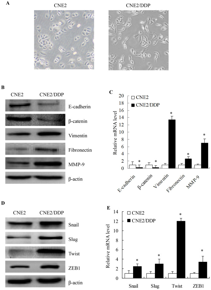 [Corrigendum] Epithelial‑mesenchymal transition is necessary for acquired resistance to cisplatin and increases the metastatic potential of nasopharyngeal carcinoma cells.