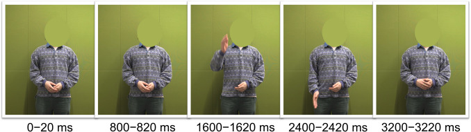 Effect of auditory cues to lexical stress on the visual perception of gestural timing