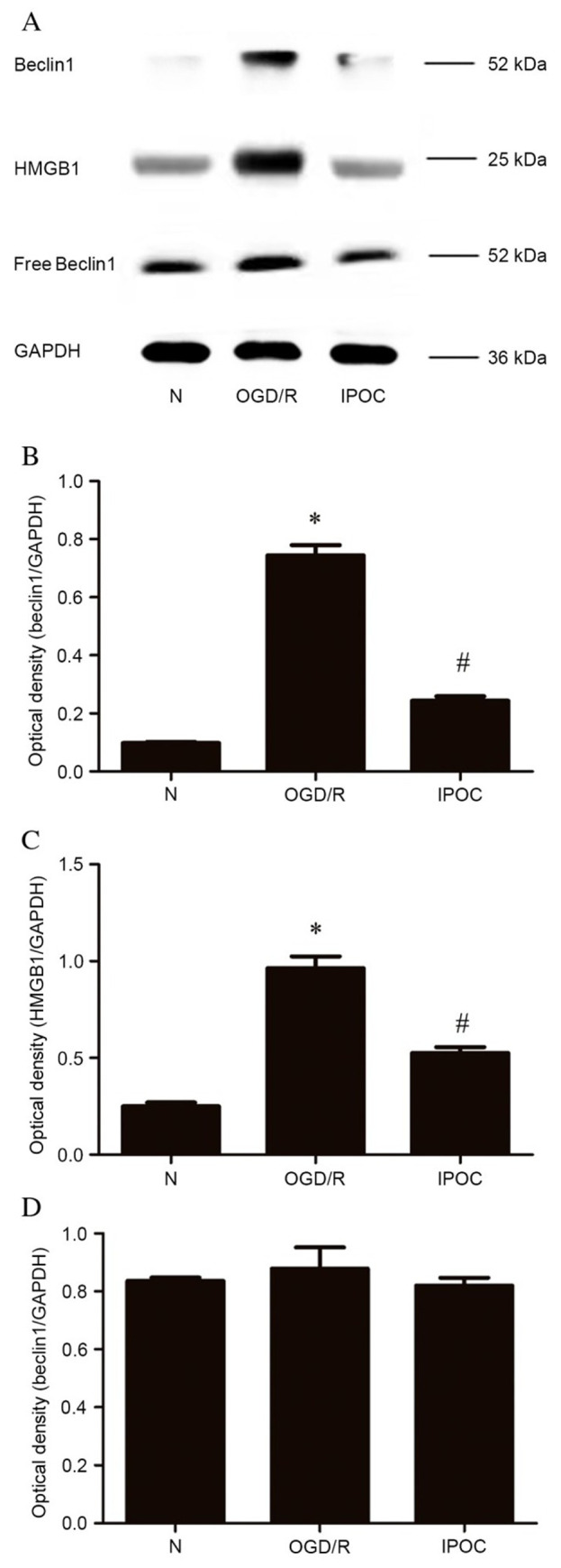 [Corrigendum] Cerebral ischemic post‑conditioning induces autophagy inhibition and a HMGB1 secretion attenuation feedback loop to protect against ischemia reperfusion injury in an oxygen glucose deprivation cellular model.