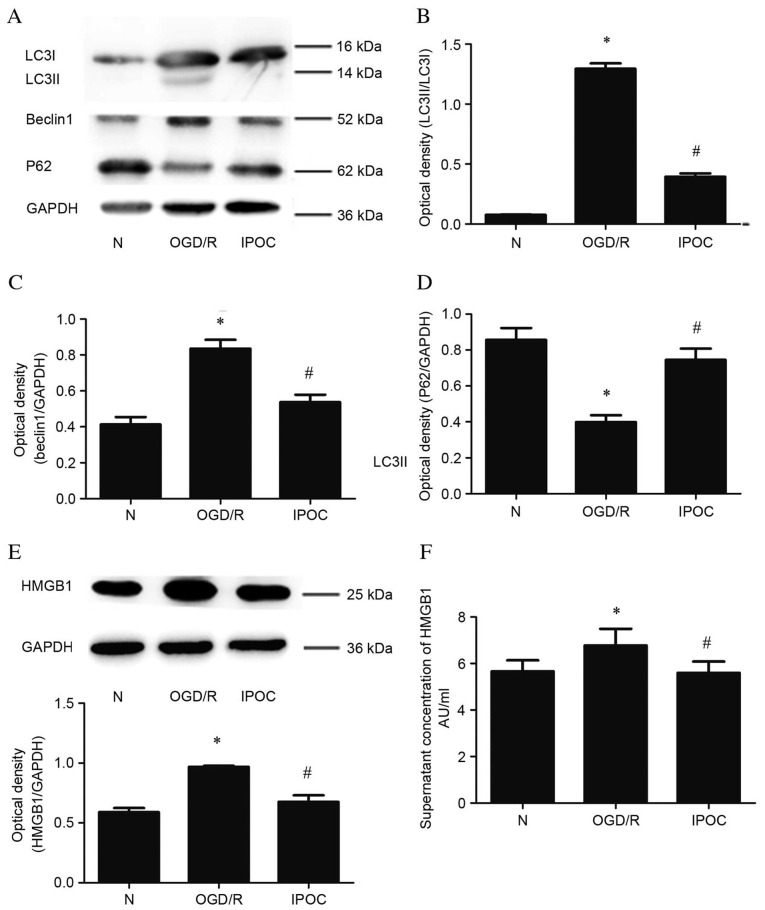 [Corrigendum] Cerebral ischemic post‑conditioning induces autophagy inhibition and a HMGB1 secretion attenuation feedback loop to protect against ischemia reperfusion injury in an oxygen glucose deprivation cellular model.
