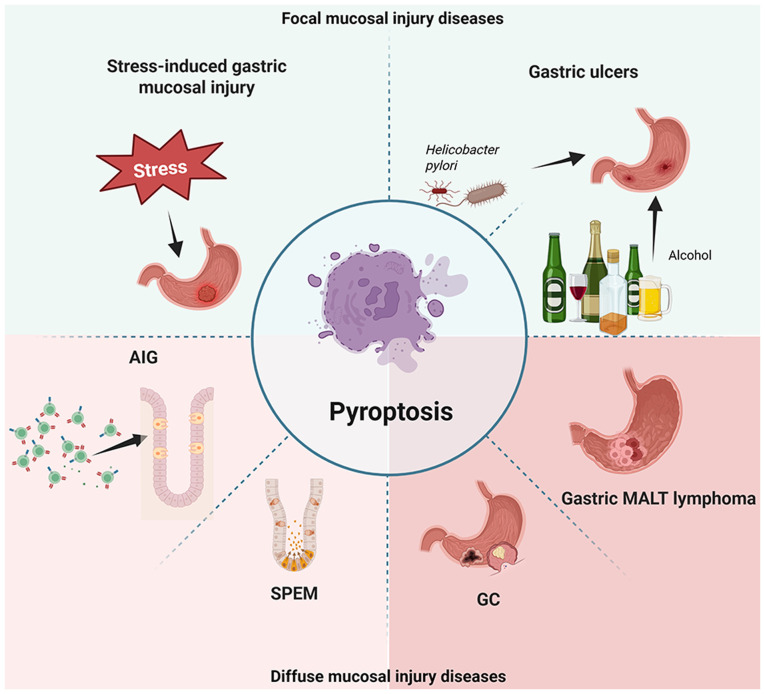 Pyroptosis in gastric mucosal injury‑related diseases (Review).