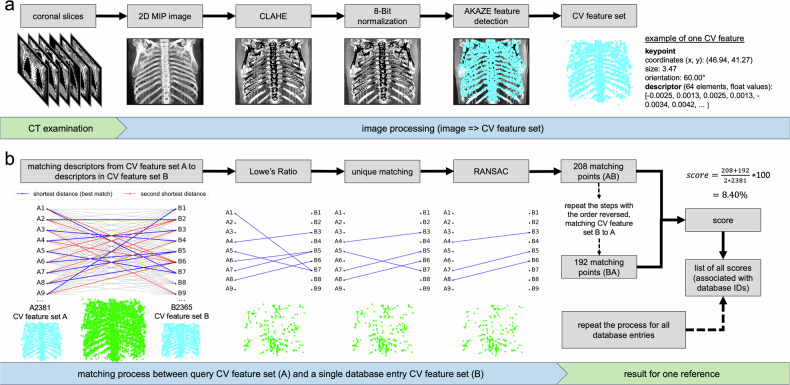 Computer vision-based personal identification using 2D maximum intensity projection CT images.