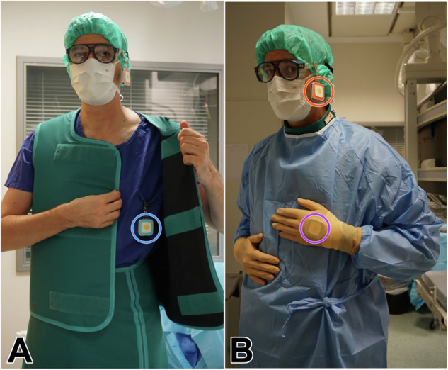 Real-time dosimetry in interventional radiology - comparing the occupational radiation exposure in fluoroscopy-guided lower extremity and abdominal procedures.