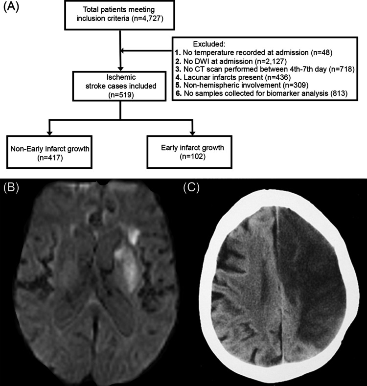 Hyperthermia and Early Growth of Cerebral Infarct: The Potential Role of Blood-Brain Barrier Permeability.