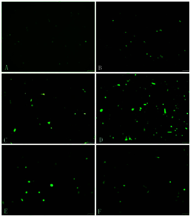 [Corrigendum] Propranolol induces hemangioma endothelial cell apoptosis via a p53‑BAX mediated pathway.