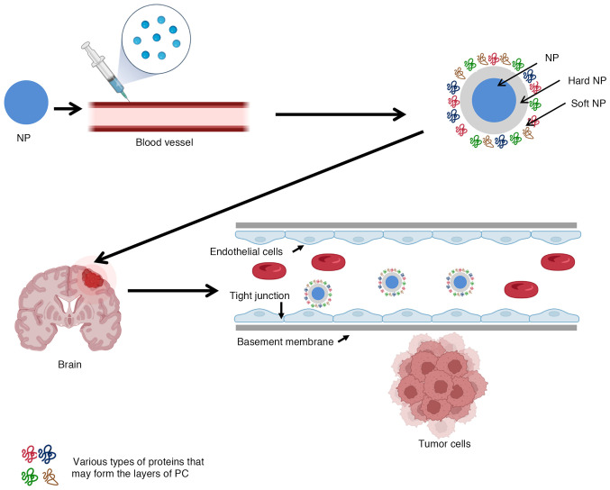 Nanoparticle‑based delivery systems for targeted therapy in brain tumors: Progress, challenges and perspectives (Review).