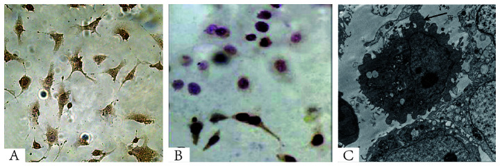 [Corrigendum] Propranolol induces hemangioma endothelial cell apoptosis via a p53‑BAX mediated pathway.