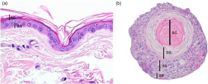 Evaluation of canine epidermis and keratinocytoids (keratinocytic organoids) by transmission electron microscopy.