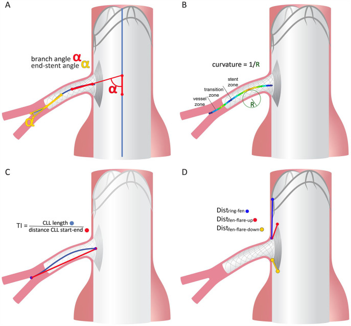 Renal and Visceral Artery Configuration During the First Year of Follow-Up After Fenestrated Aortic Aneurysm Repair Using the Anaconda Stent-graft: A Prospective Longitudinal Multicenter Study With ECG-Gated CTA Scans.